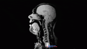 X-ray view of vocal chords moving